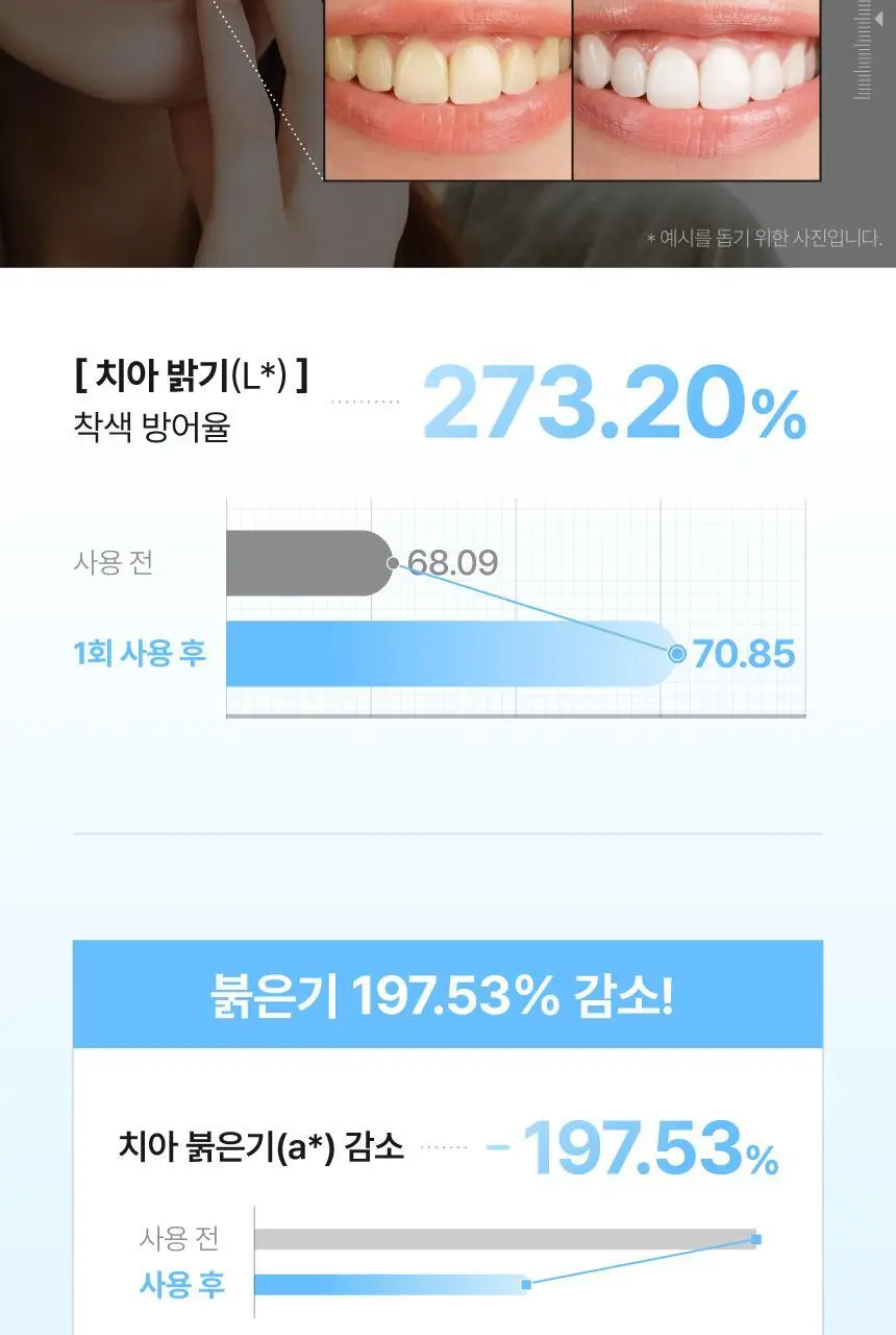 [인체시험적용완료] 프로벨 메디테라 미백 치약 100g 1개입/3개입 상세페이지 21